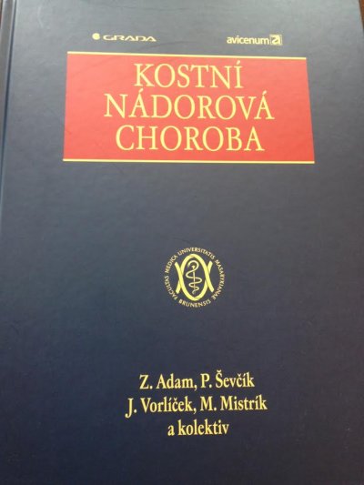 Kostní nádorová choroba